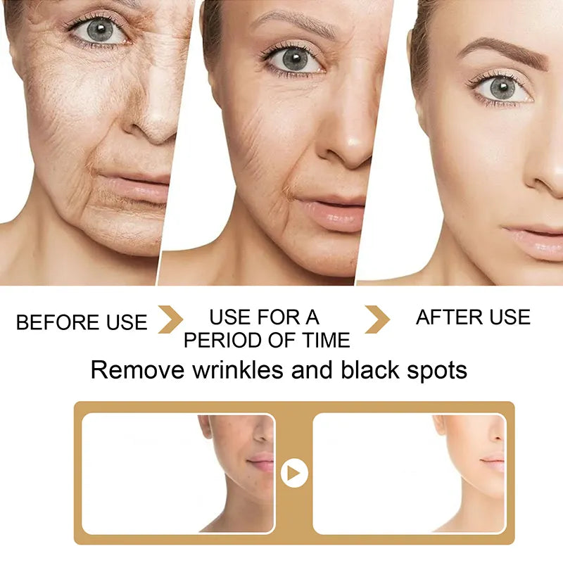 "Radiant Renewal: Advanced Acne Brightening Serum