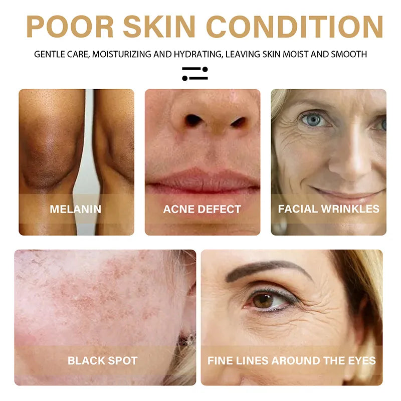 "Radiant Renewal: Advanced Acne Brightening Serum